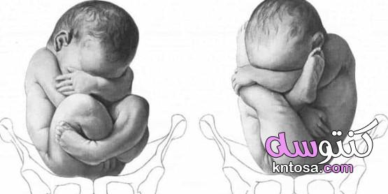 فتح الرحم ولكن الطفل لا يخرج،علامات الولادة،المشيمة المنزاحة،وضع الجنين غير طبيعي kntosa.com_01_19_157