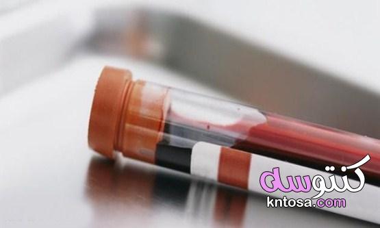 هل تحليل الدم يفطر ؟ kntosa.com_02_21_163