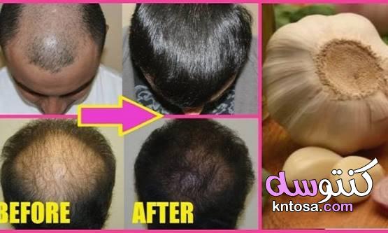 علاج تساقط الشعر في المنزل بمواد طبيعية القوم لتساقط الشعر 2020 kntosa.com_03_19_157