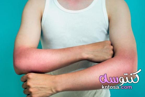 5 الظروف التي قد تسبب جلدك لتقشر kntosa.com_06_19_157