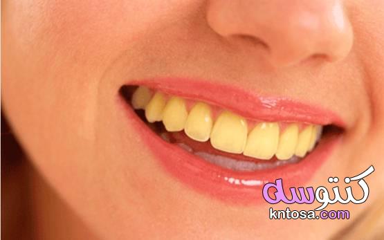 ما سبب اصفرار الأسنان وكيفية الوقاية لأسنان ناصعة البياض kntosa.com_06_21_161