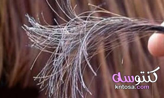 ما سبب تقصف الشعر وعلاجه نهائيًا بالوصفات الطبيعية kntosa.com_06_21_162
