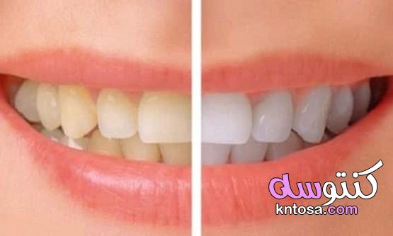 كيف تتخلص من صفار الأسنان نهائيًا بوصفات منزلية سهلة وبسيطة kntosa.com_09_21_162