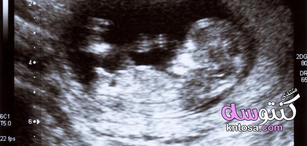 أعراض الحمل في الأسبوع الثاني,الحمل في الشهر الثاني وأعراضه,نصائح للحامل في الشهر الثاني,حمل وولاده kntosa.com_10_19_154