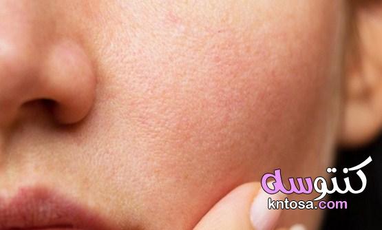 افضل علاج مسامات الوجه بأكثر من طريقة kntosa.com_10_21_161