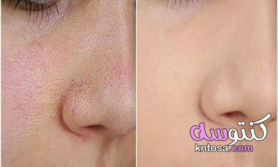 افضل علاج مسامات الوجه بأكثر من طريقة kntosa.com_10_21_161