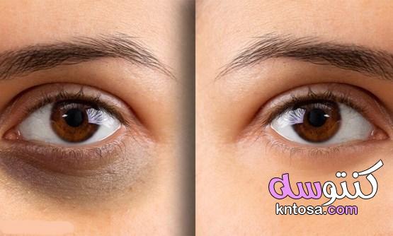 علاج الهالات السوداء حول العين kntosa.com_11_22_164