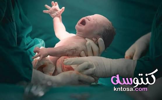 الولادة القيصرية.. فوائد ومخاطر للأم والمولود 2020 kntosa.com_12_19_157