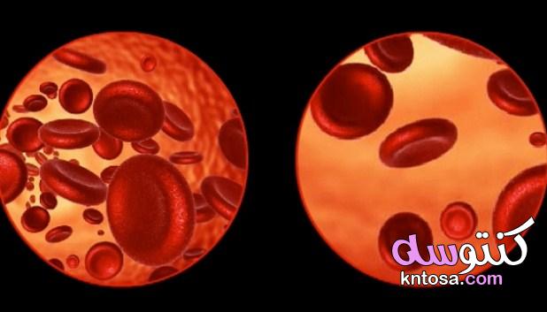 فقر الدم وعلاجه بالأعشاب · ‏كيف تعالج فقر الدم عند الأطفال · ‏أفضل علاج لفقر الدم kntosa.com_13_19_156