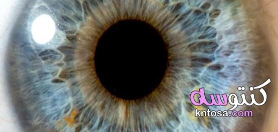 مكوّنات العين البشريّة ووظائفها،المحافظة على العين، حالات مرضية تصيب العين kntosa.com_13_19_157