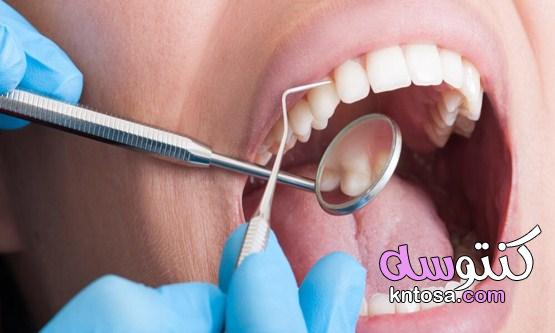 اضرار تنظيف الاسنان عند الطبيب| 9 نصائح بعد تنظيف الاسنان من الجير kntosa.com_17_21_161