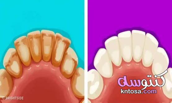 6 طرق طبيعية لإزالة طبقة البلاك من الأسنان 2020 kntosa.com_18_19_157