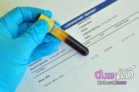 أهمية وسعر تحليل الحمل بالدم وطريقه قراءته بالتفصيل kntosa.com_18_21_161