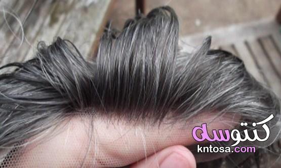 حقائق ومعلومات مهمة حول زراعة الشعر 2020 kntosa.com_19_19_157
