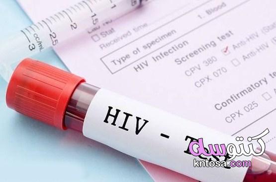 معلومات عن تحليل hiv وسعره بالتفصيل