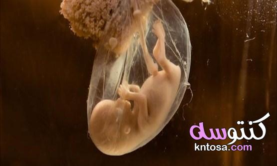 كيس الحمل في الرحم ،وقت ظهور كيس الحمل حول الجنين ،متى يظهر كيس الجنين في السونار kntosa.com_22_19_156