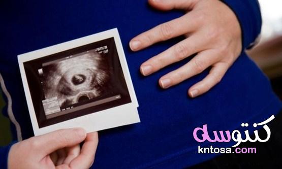كيس الحمل في الرحم ،وقت ظهور كيس الحمل حول الجنين ،متى يظهر كيس الجنين في السونار kntosa.com_22_19_156