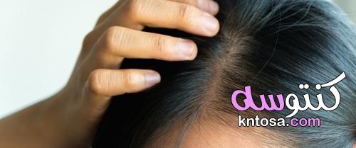 خلطة لعلاج الشعر المتساقط والخفيف وعلاج ثعلبة الشعر في الرأس kntosa.com_22_21_162