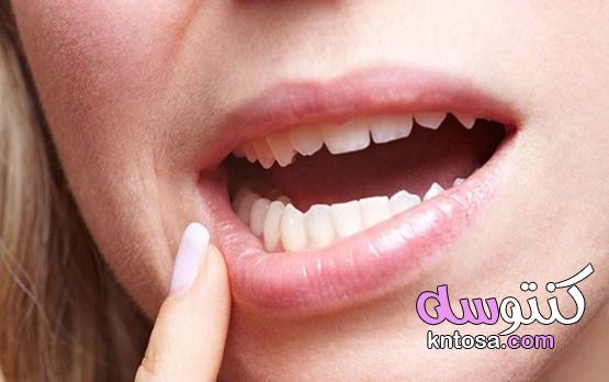 سبب جفاف الفم أثناء النوم ، أسباب جفاف الريق،علاج جفاف الفم بالطرق الطبي kntosa.com_25_19_156
