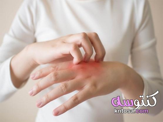 التهاب الأصابع.. أسباب تكشف عن أمراض خفية أصابع النقانق 2020 kntosa.com_25_19_157