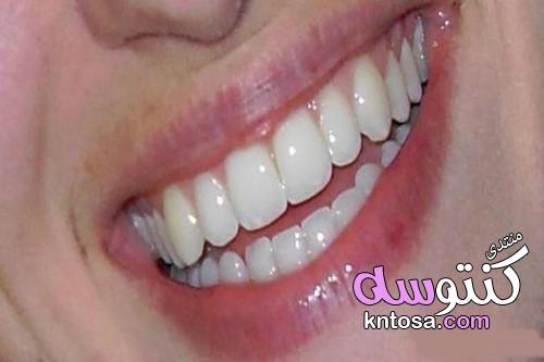 كيفية الحصول على أسنان بيضاء2019,طرق تبييض الاسنان,وصفات طبيعية لتبييض الاسنان kntosa.com_26_19_155
