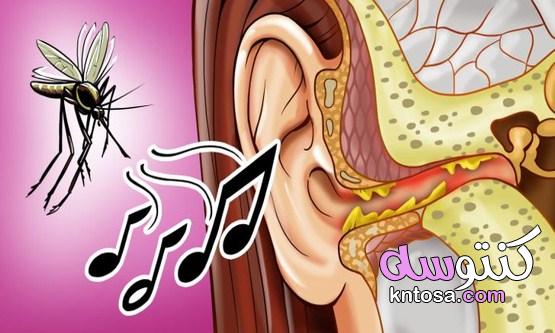 لماذا يغني البعوض بالقرب من أذنيك وكيف يمكنك تجنبه kntosa.com_26_21_161