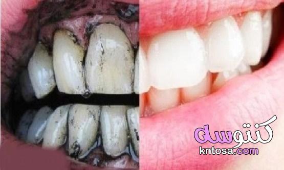 افضل طريقة لتبيض الاسنان kntosa.com_27_21_162
