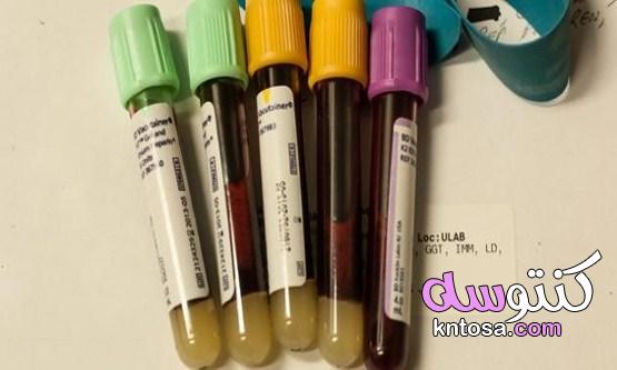 تحليل نسبة الكالسيوم في الدم