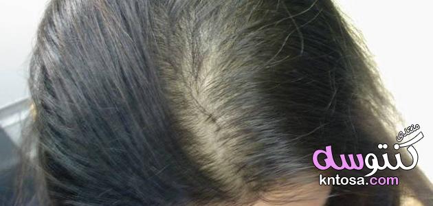 علاج الشعر الخفيف,كيفية علاج الشعر الخفيف,تكثيف الشعر الخفيف وتطويله طبيعياً,طرق بسيطة للشعر الخفيف kntosa.com_30_19_155