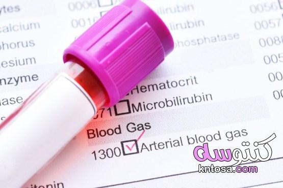 كيفية اجراء تحليل غازات الدم